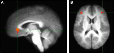 A Neurosociological Theory of Culturally and Structurally Situated Cognition and Ethno-Racial Stress